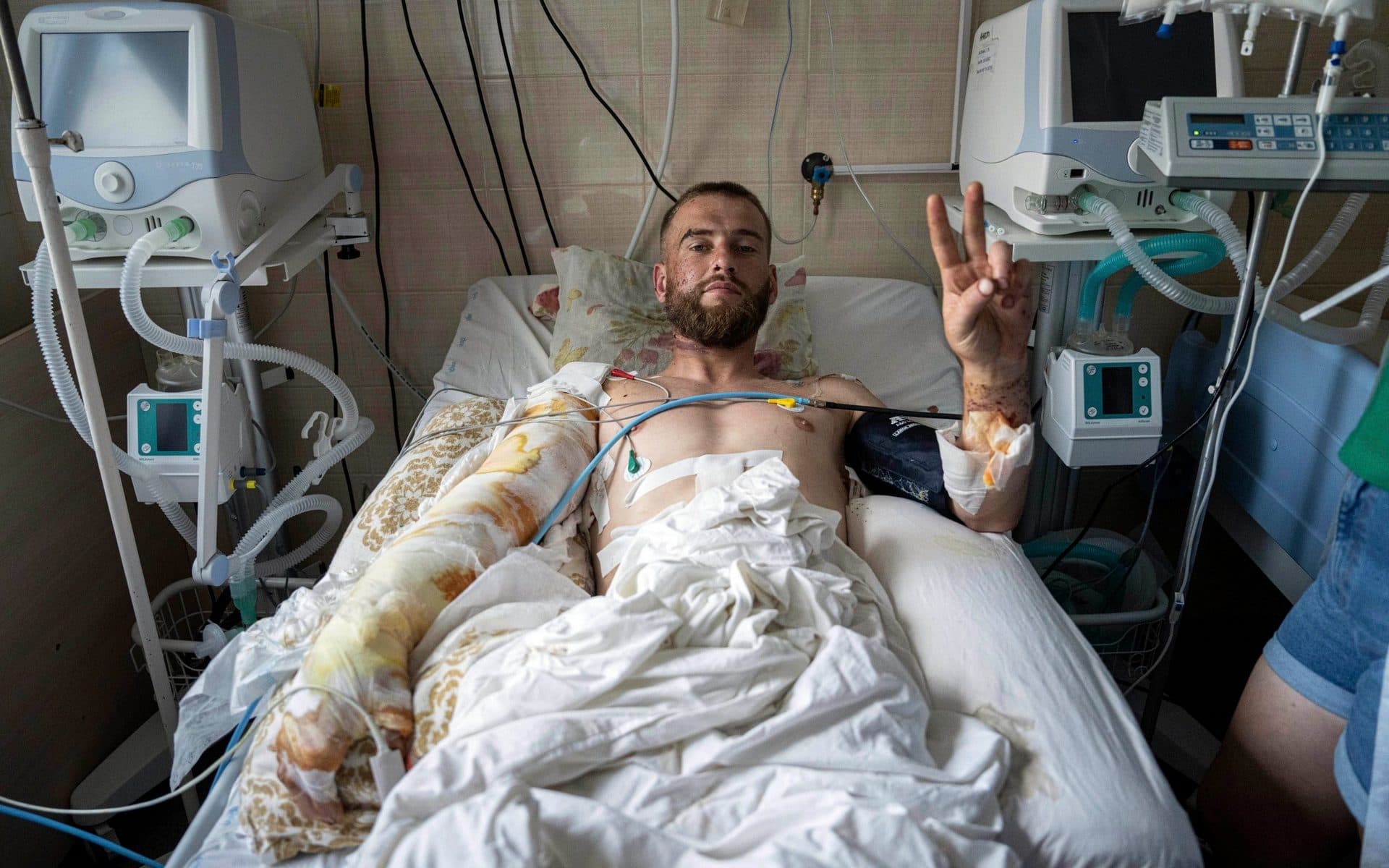 an Ukrainian serviceman shows a Victory sign at the ICU of Mechnikov Hospital in Dnipro