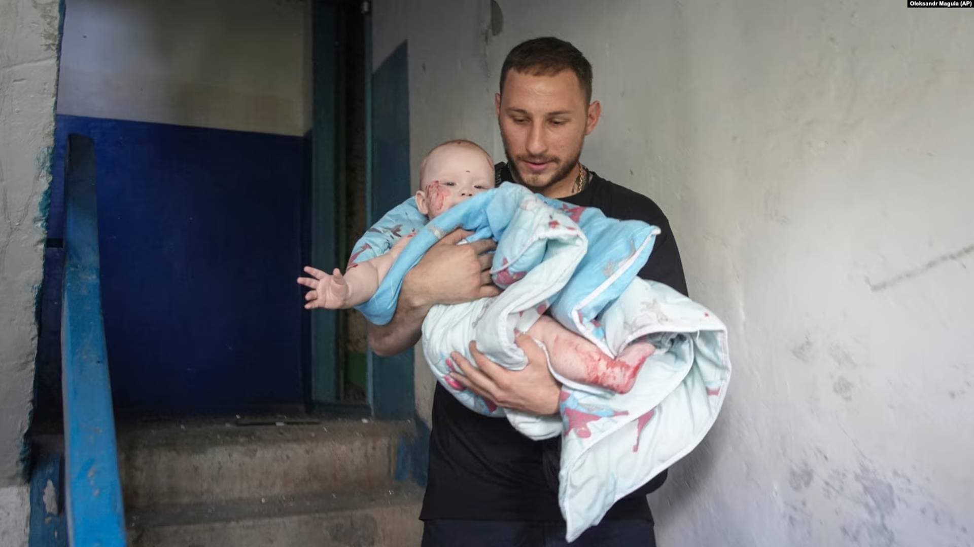 A man carries an injured baby following the missile strike